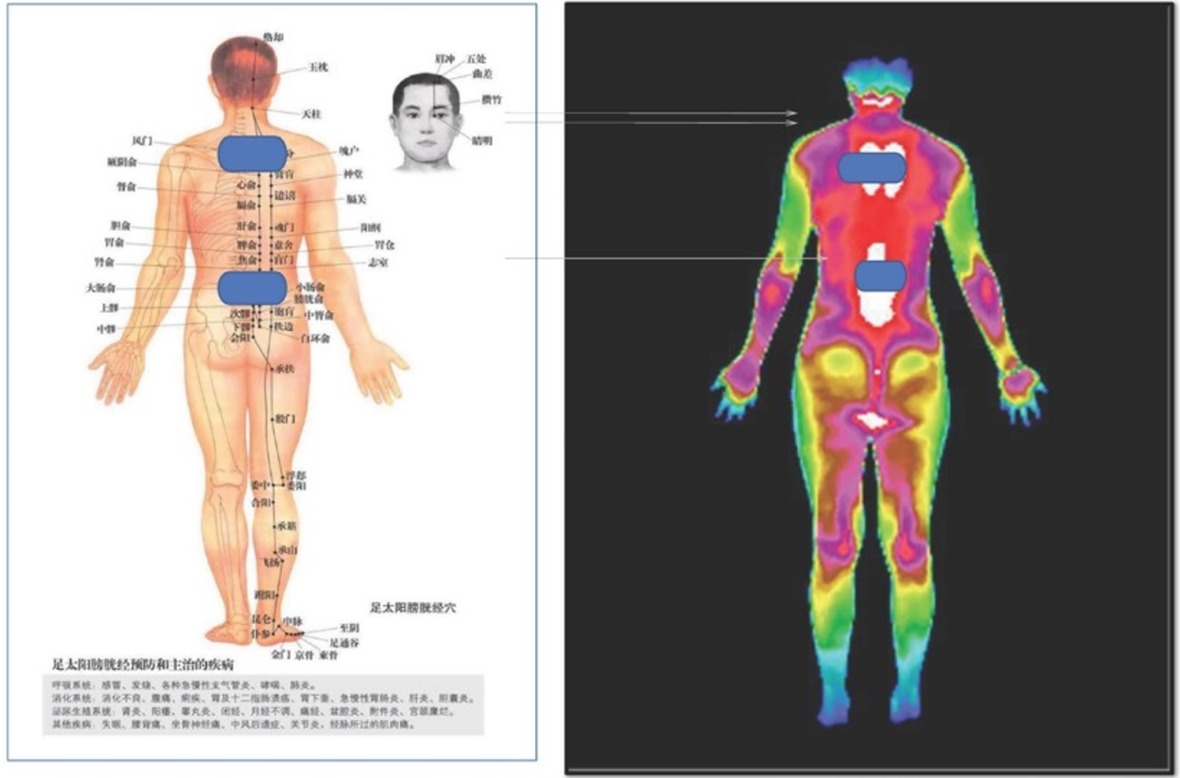 电生理适宜技术？没听过？那可要了解一下了~