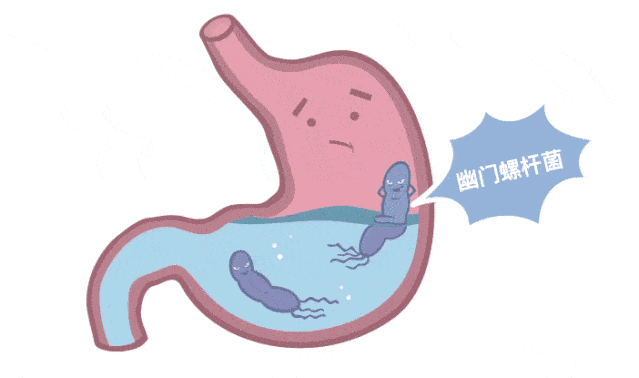 腹胀、胃痛、不消化……你有没有想过可能与幽门螺杆菌感染有关