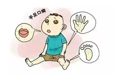 手足口病又到高发季，孩子有这些症状赶紧就医